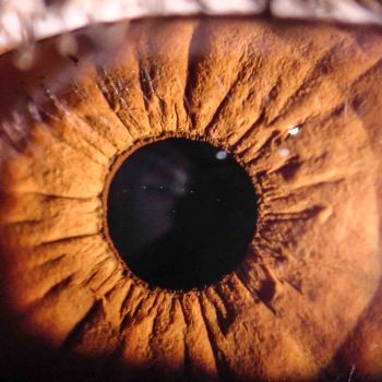 Iris Auge 15